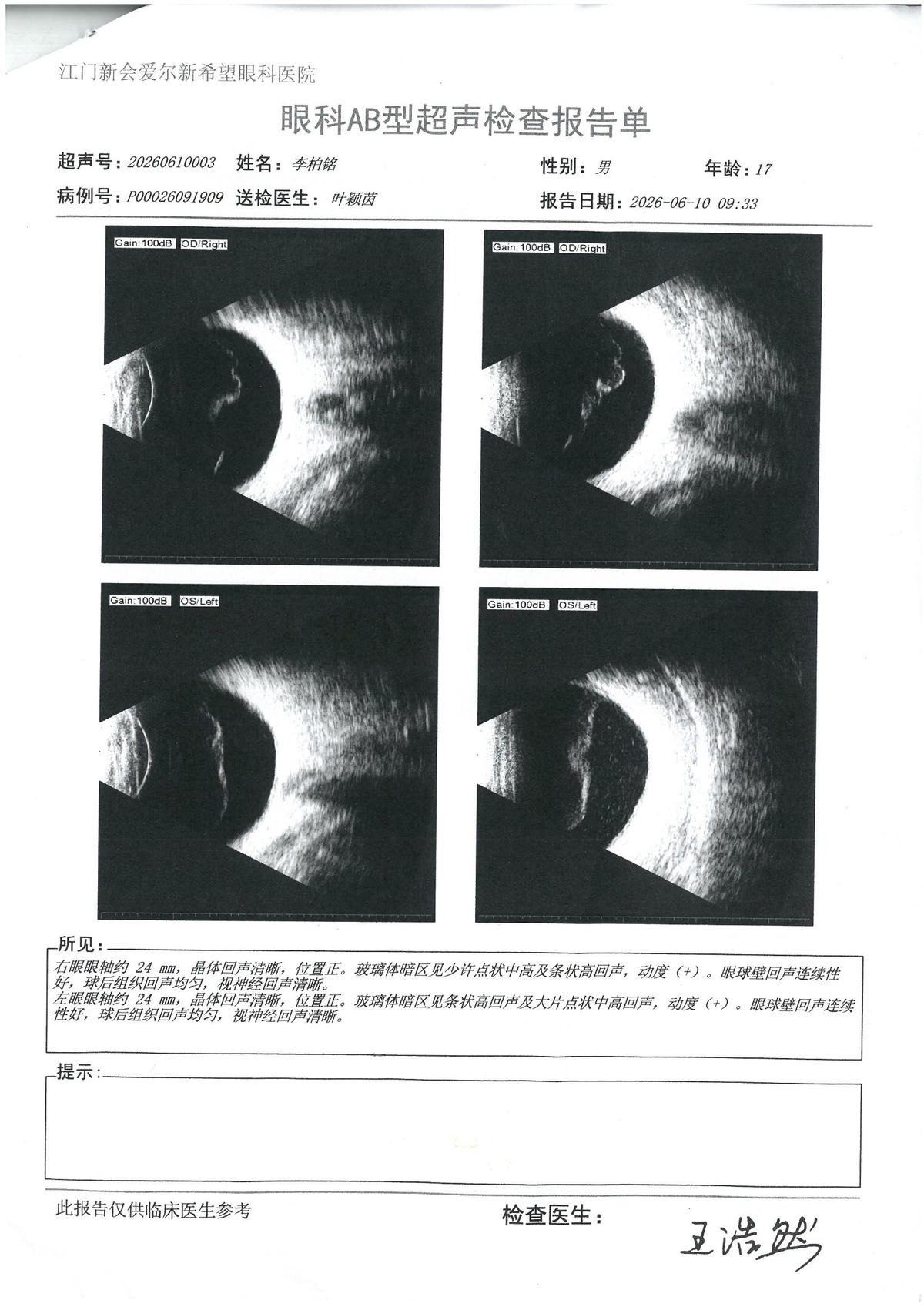 AB超 · #155