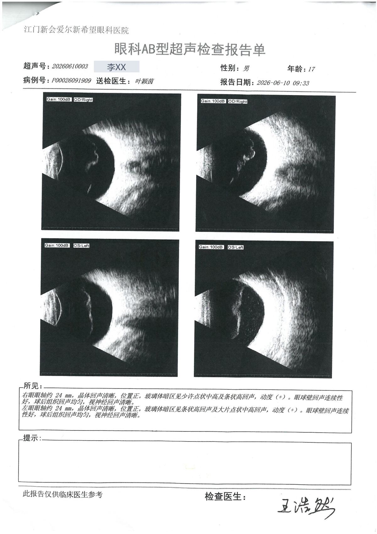 AB超 · #155