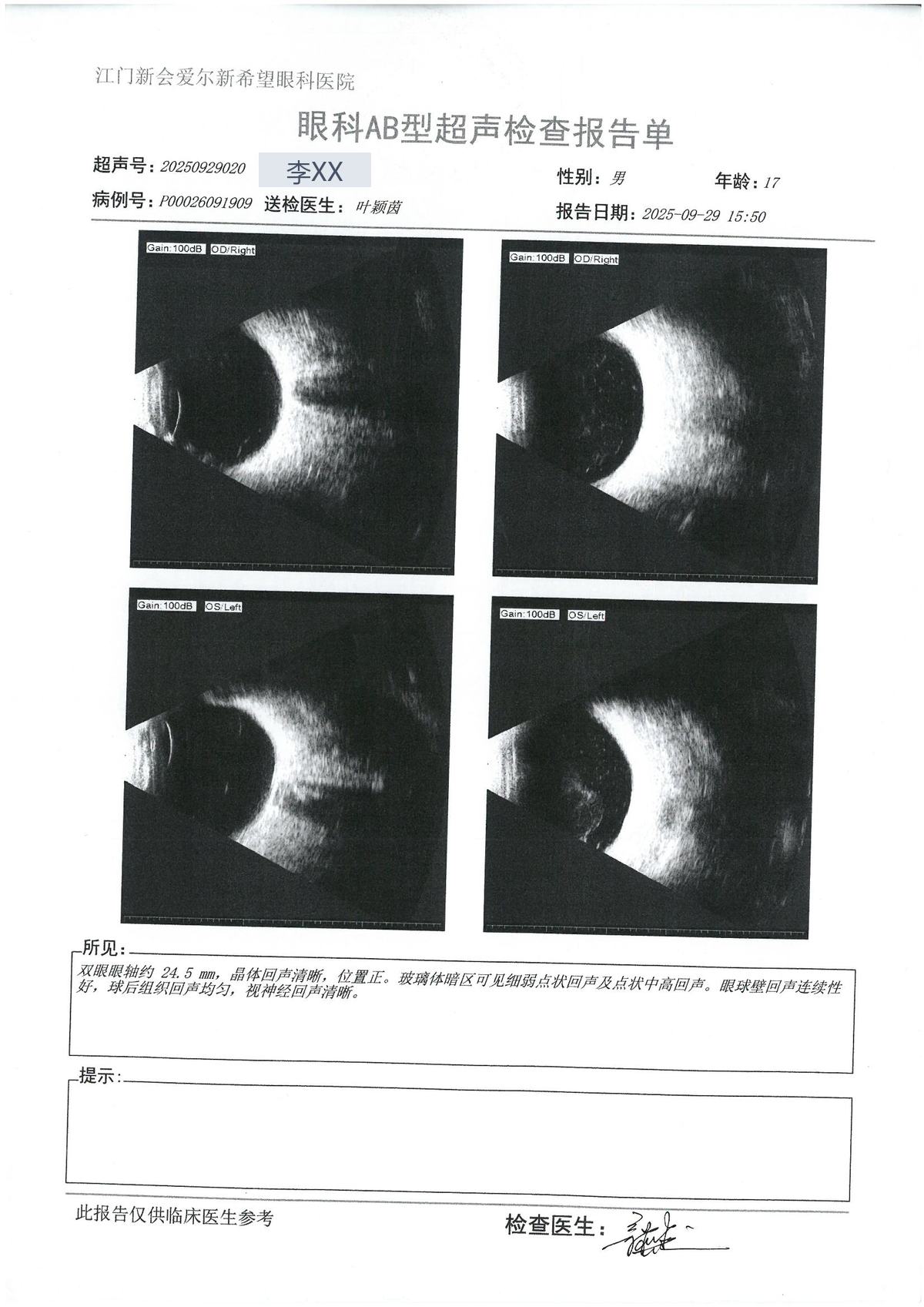 AB超 · #160