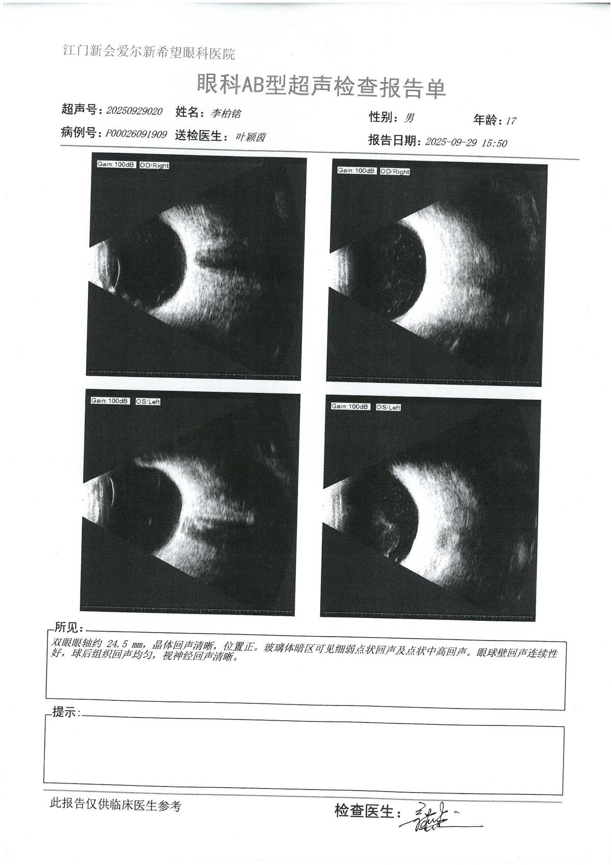AB超 · #160