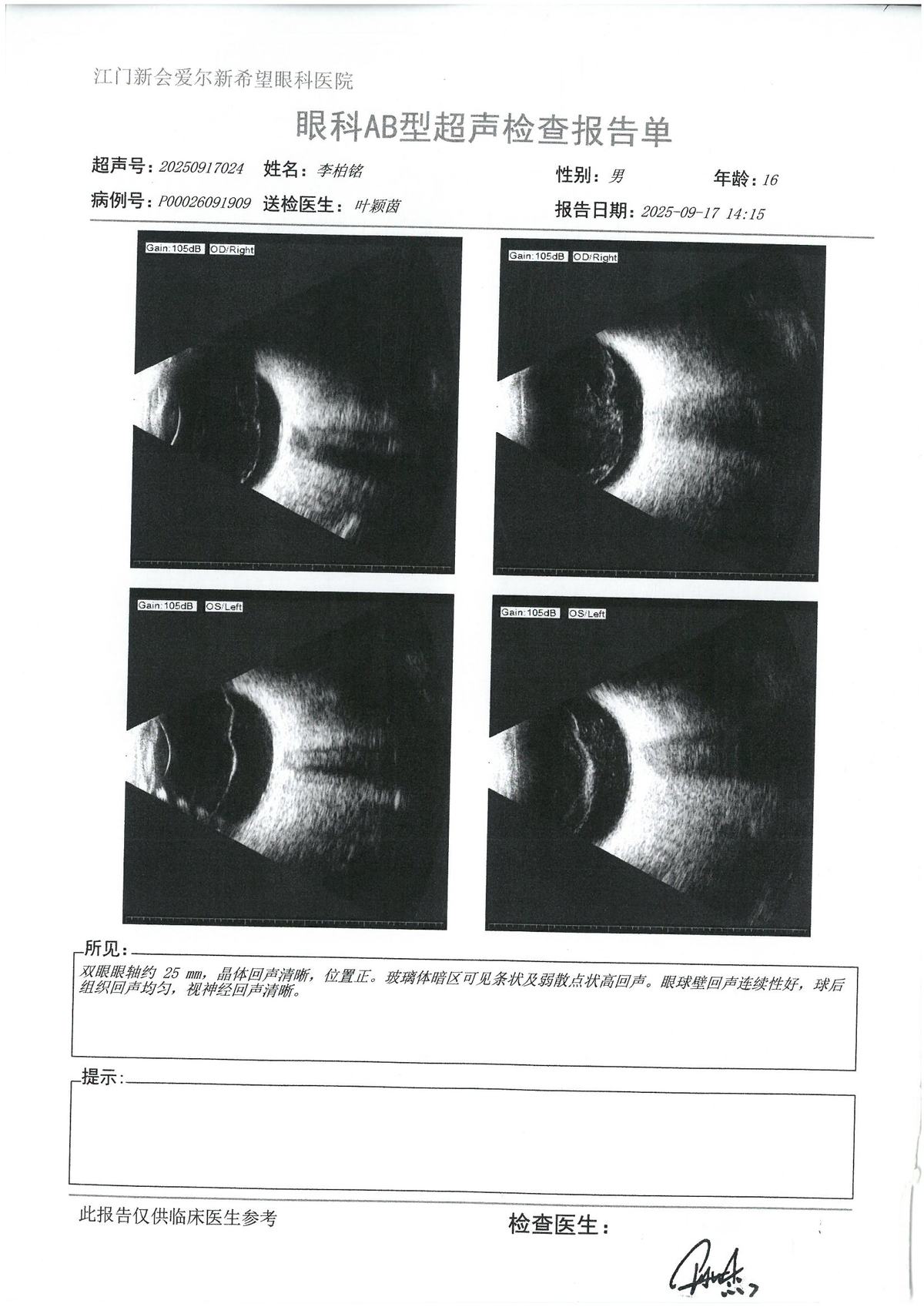 AB超 · #162