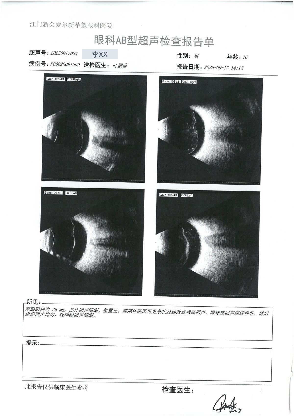 AB超 · #162