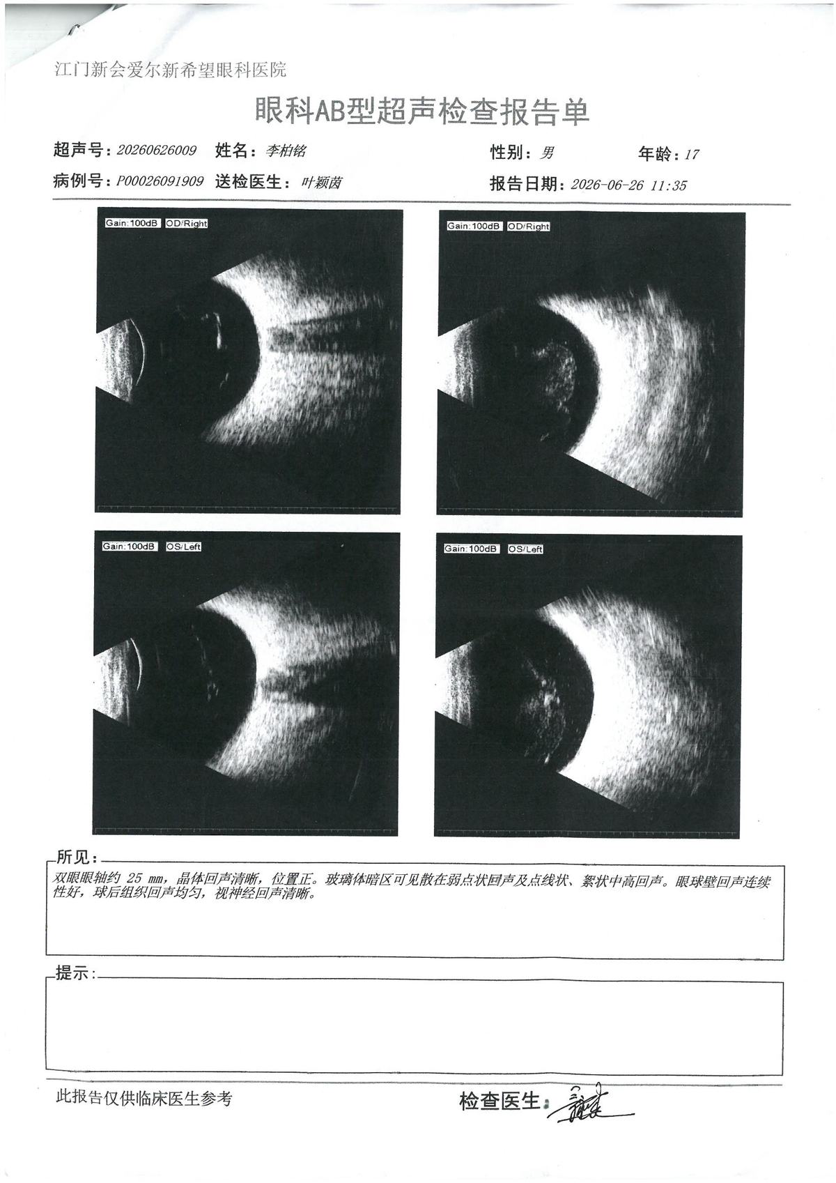 AB超 · #190