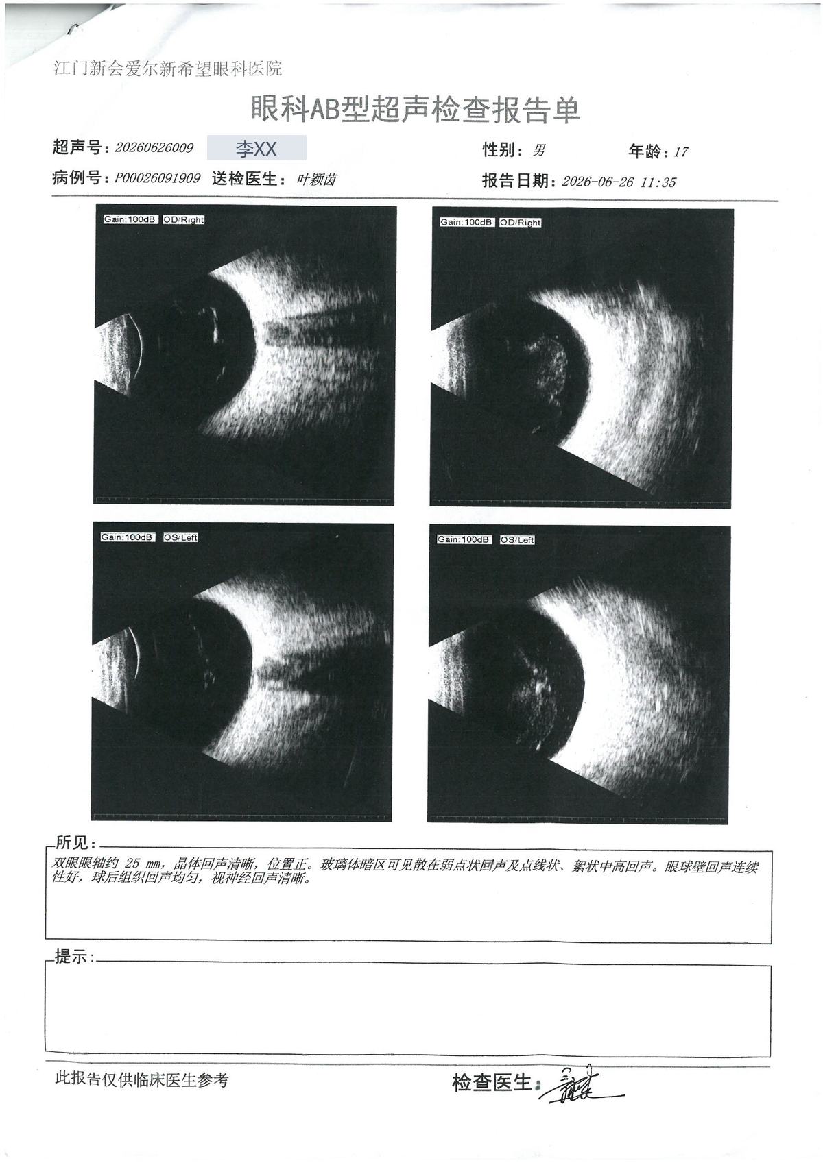 AB超 · #190